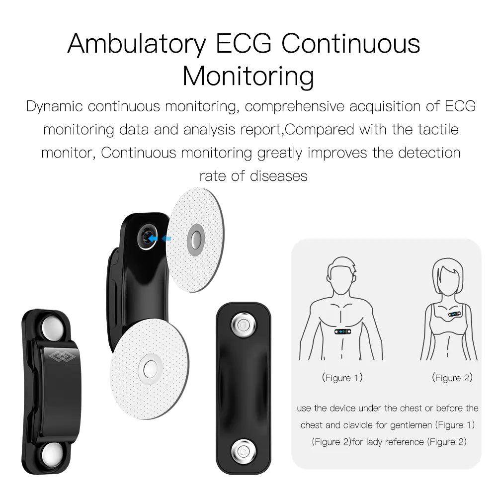 Smart Bracelet with 24-Hour ECG and Health Monitoring