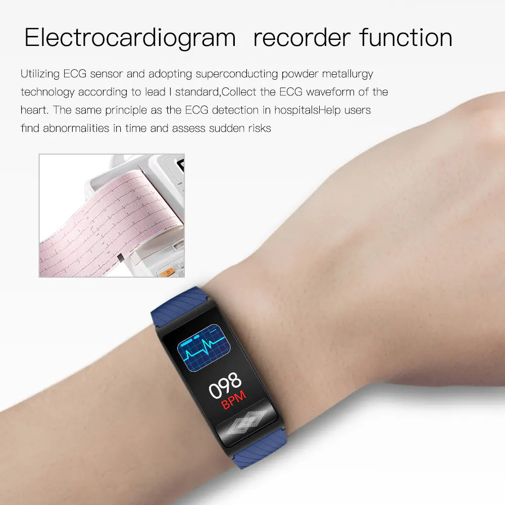 Smart Bracelet with 24-Hour ECG and Health Monitoring